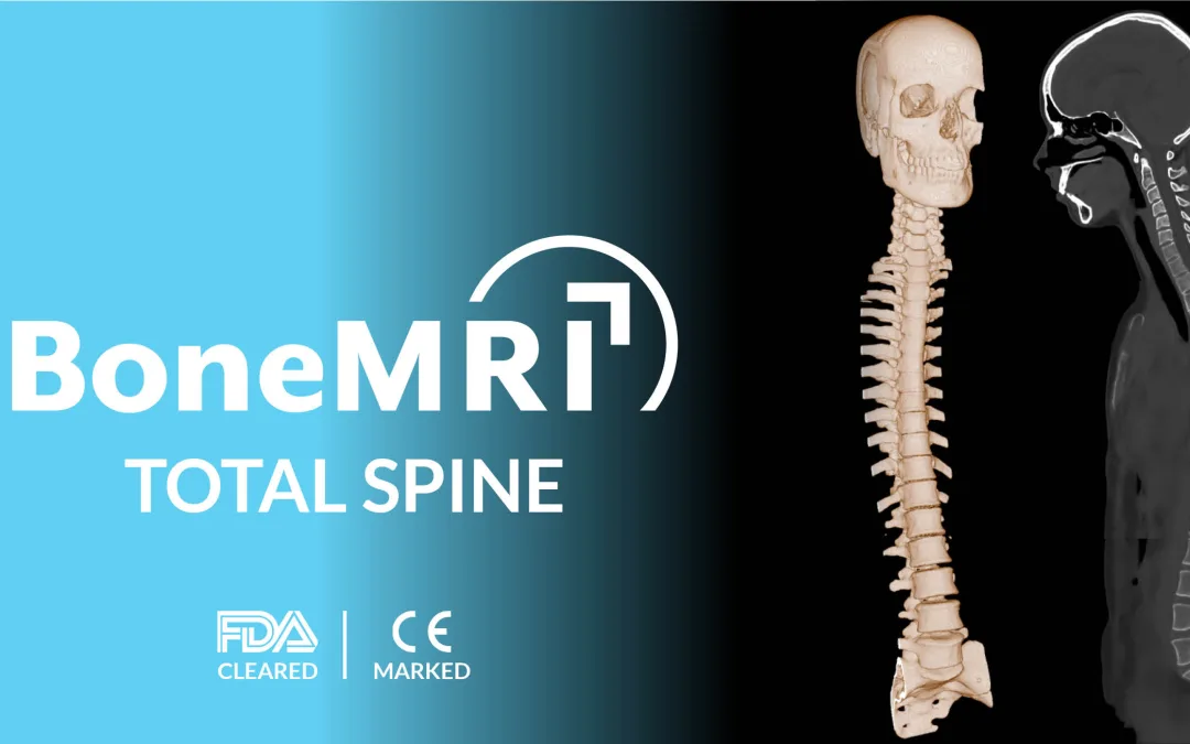 BoneMRI for the Total Spine